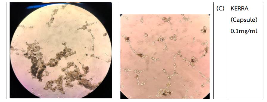 การวิจัย - kerra ยาเคอร่า