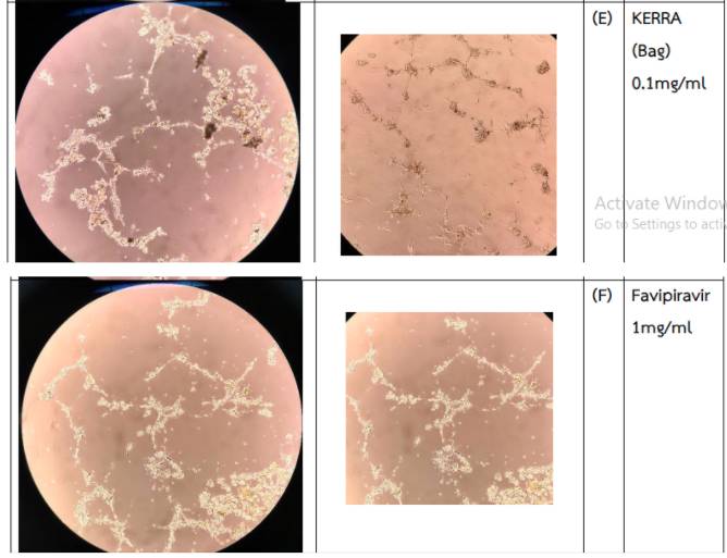 การวิจัย - kerra ยาเคอร่า