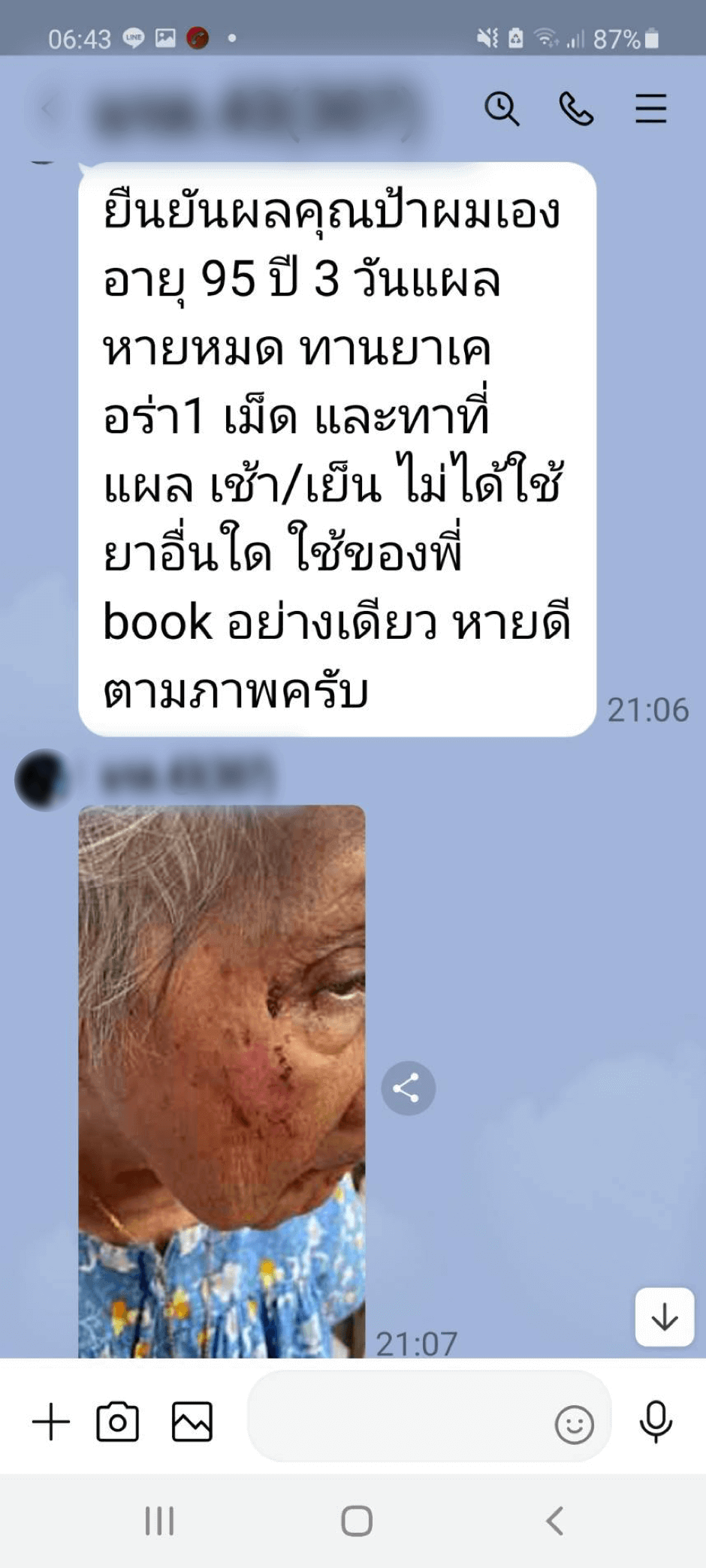 รีวิว ทานสมุนไพรยาเคอร่า kerra