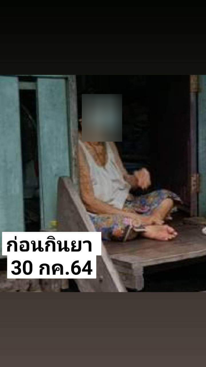 รีวิว ทานสมุนไพรยาเคอร่า kerra